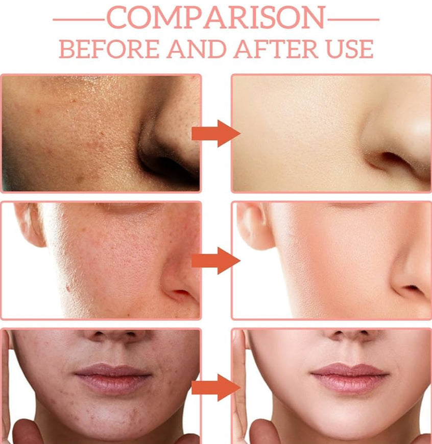 Anti-wrinkle Facial Serum