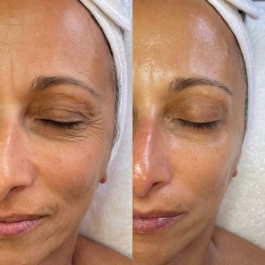 Glow-Wand Red Light Therapy