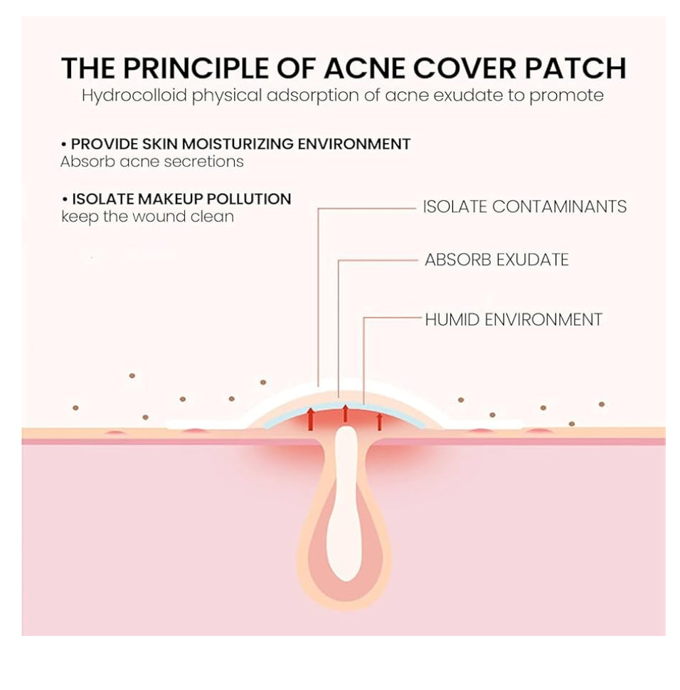 Acne Star Patches