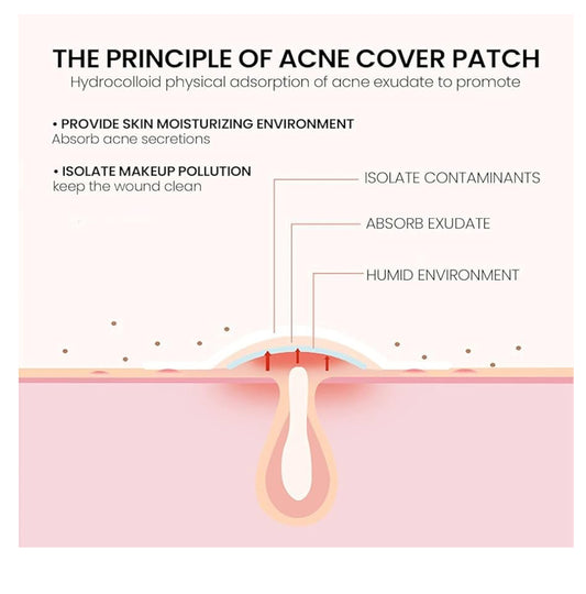 Acne Star Patches