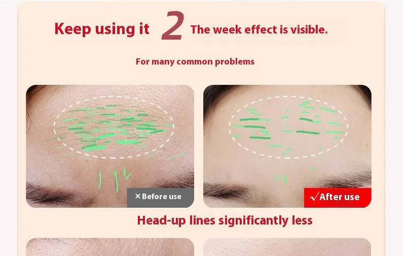 Glow-Wand Red Light Therapy